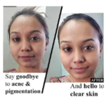 Helps with Skin Issues