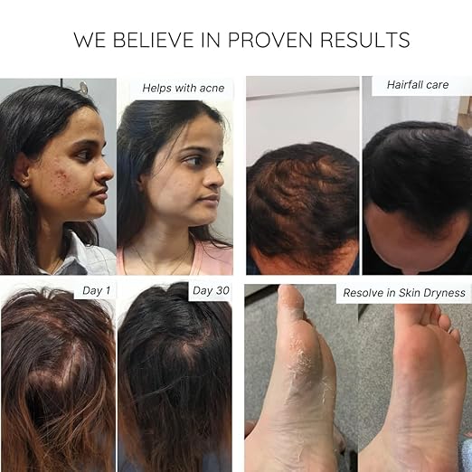 Water Tap Softner - Image 6